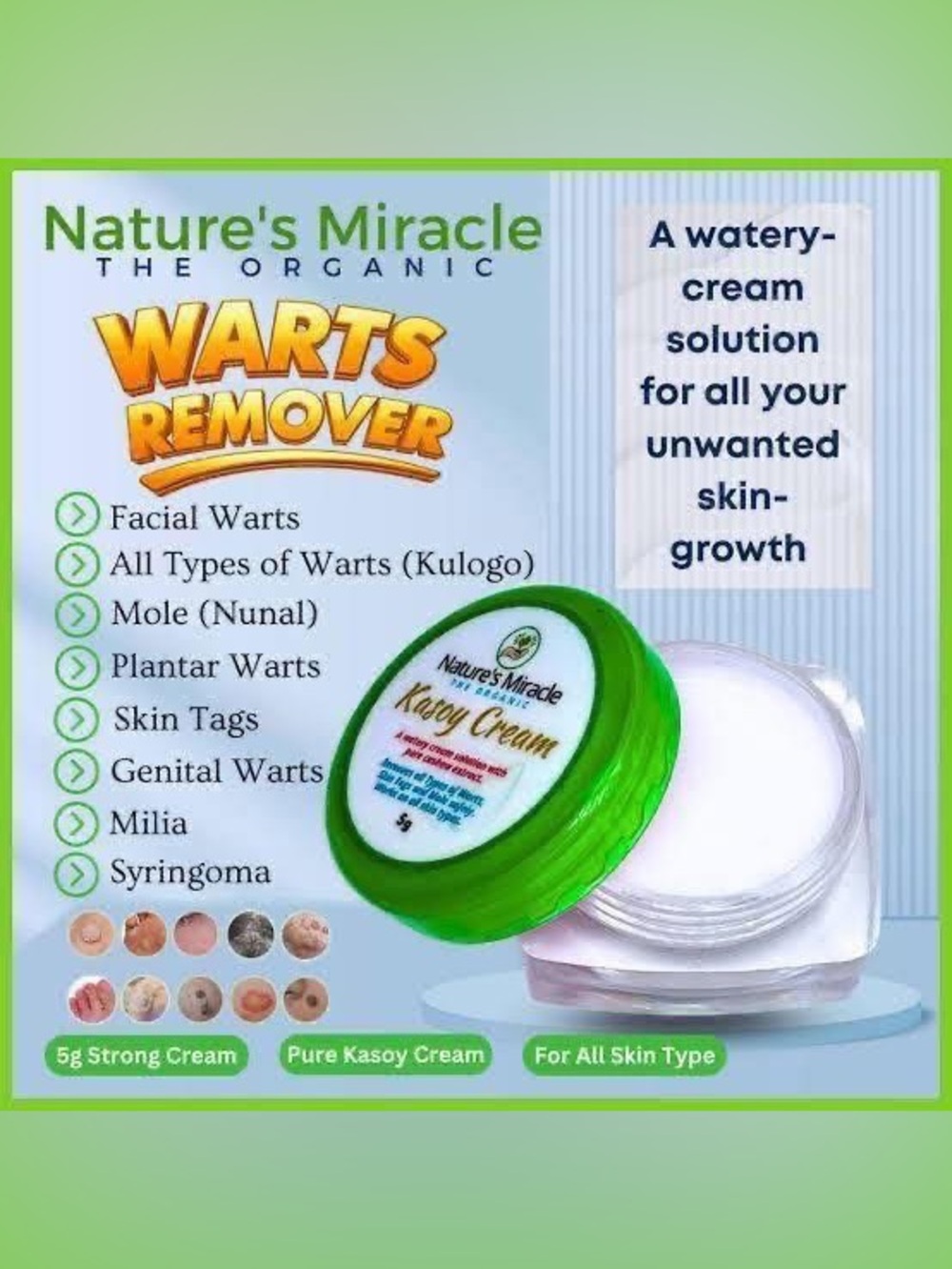 Kasoy Cream - Wart Remover and Skin Tags